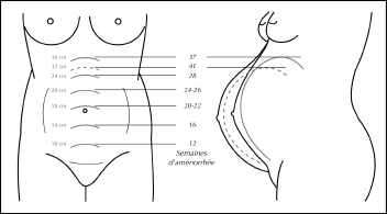évolution de la hauteur utérine selon l'âge gestationnel (d'après Lansac)