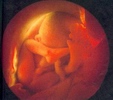 Fœtus à 3 mois